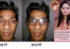 आपकी आँखों में टोसिस है या नहीं स्वयं कैसे जाने  - जाँच करना सीखे डॉ सुमित्रा से....