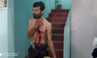 CG CRIME: सिर पर खून सवार आरोपी ने भाई के सीने में घोंपा छूरा...खून से लथपथ थाने पहुंचा युवक कोतवाली थाना..हालत नाजुक..