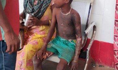 बिजली विभाग की लापरवाही के कारण करंट लगने से एक मासूम की हालत गंभीर
