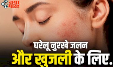 Burning And Itching : घरेलू नुश्खे जलन और खुजली के लिए, ये 5 कारण जानें इससे छुटकारा पाने के उपाय.