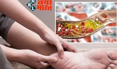 High Cholesterol Symptoms: जब पैरों में होने लगे ऐसी दिक्कतें, तो  बढ़ गया है आपका कॉलेस्ट्रॉल , ना करें नजरअंदाज.