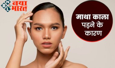 Darkening of forehead: माथे की त्वचा काली पड़ने के पीछे हो सकते हैं ये 5 कारण, जानें कालेपन को कम करने के उपाय.