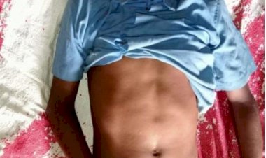 सर्प दंश से फिर एक बार सुना हुआ माँ का गोद सोन निवासी बमलेश पटेल 11 वर्ष अपने बड़े भाई कमलेश पटेल को जगाने गए थे बिस्तर में छिपे जहरीले सांप ने काटा अंधविस्वास के कारण नहीं मिला डॉक्टरी इलाज मौत पढ़े पूरी खबर