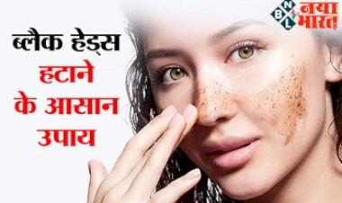 How To Get Rid Of Black Heads: टूथपेस्ट और बेकिंग सोडा जैसी इन 5 चीजों से हटाएं ब्लैक हेड्स, जानें इस्तेमाल करने की सही विधि...