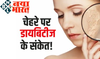 Diabetes signs on face : डायबिटीज के हैं ये 3 संकेत, दिखाई दे तो तुरंत लें एक्शन... नही तो हो सकती है डायबिटीज...