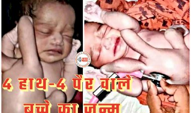 अजब-गजब: 4 हाथ-4 पैर वाले बच्चे का जन्म... 4 हाथ-4 पैर वाले बच्चे को देखने उमड़ी भीड़... डॉक्टर्स भी रह गए हैरान... देखें तस्वीरें.....