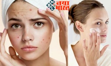 Monsoon Skin Problems: बारिश के दिनों में इन 4 चीजेंसे करें परहेज, वरना चेहरे पर हो जाएंगे फुंसी-पिंपल्स...