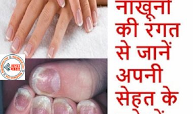 Peeling Of Nails : नाख़ून की रंगत से जाने अपनी सेहत के बारे में पूरी जानकारी...
