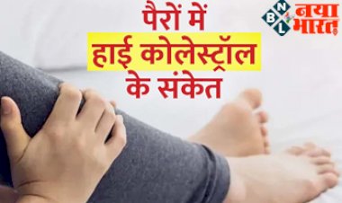 High Cholesterol Signs: पैरों में दिखने वाले हाई कोलेस्ट्रॉल लेवल के संकेत और लक्षण, ना करें इग्नोर, लाइफस्टाइल में करें ये बदलाव...