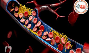 High Cholesterol: शरीर में यदि हाई कोलेस्ट्रॉल है तो पैर देने लगते हैं ये संकेत, अनदेखा करने की गलती से भी न करें भूल...