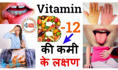 Vitamin B12 Deficiency : जीभ दिखे ऐसी तो समझ जाएं कि शरीर में हो गई है Vitamin B12 की बहुत कमी, जाने इसके  प्रोब्लम्सऔर उपाय...