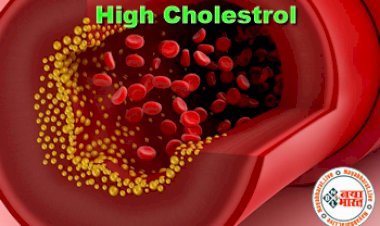High Cholestrol: कोलेस्ट्रॉल की जांच कराते समय ध्यान रखें ये बातें, खतरे में डाल सकती हैं ये गलतियां....