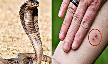 CG मां-बेटी की मौत :माँ और 2 मासूम बेटियों को जहरीले सांप ने डसा…बेटियों के साथ सो रही थी महिला, सांप की नहीं लगी भनक…तीनों को जहरीले सांप ने डंसा…2 की मौत ,एक बेटी गंभीर…