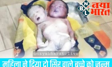CG- दो सिर वाला बच्चा: महिला ने दिया दो सिर वाले बच्चे को जन्म... देखने के लिए उमड़ी लोगों की भीड़... जन्म लेने के 2 घंटे बाद ही बच्चे की मौत....