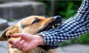 CG Dog Attack: पालतू कुत्ते ने पड़ोसी पर किया हमला... पैर और हाथ में काटा... कुत्ते मालिक पर जुर्म दर्ज.....