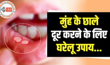 Mouth Ulcers Remedies: मुंह में अक्सर हो जाते हैं छाले, तो अपनाए इन  6 घरेलू उपायों को मिलेगा बेहतर आराम....