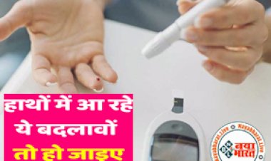 Diabetes symptoms on hand: डायबिटीज की तरफ इशारा करते हैं ये लक्षण, हाथों पर भी दिखता है इसका असर...कहीं आप तो नहीं हो रहे है इसका शिकार...