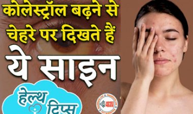 High Cholesterol Symptoms: कोलेस्ट्रॉल बढ़ने पर चेहरे पर दिखते है ये 3 साइन, इग्नोर न करें ये लक्षण...