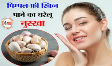 Pimples Home Remedies: आजमाएं ये 5 घरेलू नुस्खें और पाये पिम्पल-फ्री स्किन, बस जान लें इस्तेमाल के ये तरीके....