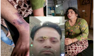 पत्नी को मारने के लिए रची खौफनाक साजिश: पहली बीवी के प्यार में पागल हुआ पति, दूसरी पत्नी को सांप से कटवाया, जहर के इंजेक्शन भी लगाए.....