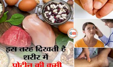 Protein Deficiency: स्वस्थ शरीर के लिए प्रोटीन है जरूरी, प्रोटीन की कमी से शरीर में दिखते हैं ये लक्षण...