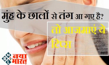 Home remedy tips : मुंह में बार-बार छाले होने से परेशान हैं, अब नहीं सहा जाता दर्द... तो छालों को गायब करने के ये तरीके जान लीजिए....