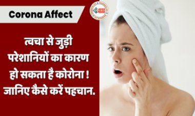 Corona Affect: कोरोना वायरस के लक्षण! त्वचा से जुड़ी परेशानियों का कारण हो सकता है कोरोना, जानिए कैसे करे पहचान....