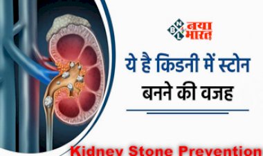 Kidney Stone Prevention : ज्यादा नमक खाने वाले हो सकते है इस समस्या से ग्रसित, किडनी में बन सकता है स्टोन, इन 5 आसान तरीकों को अपना लें जिंदगी...