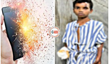 बम की तरह फटा स्मार्टफोन: मोबाइल चार्ज पर लगाकर गेम खेल रहा था बच्चा... स्मार्टफोन हुआ ब्लास्ट... आंख खराब... हाथ की उंगली कटी... फट जाएगा आपका भी मोबाइल अगर की ये गलतियां.....