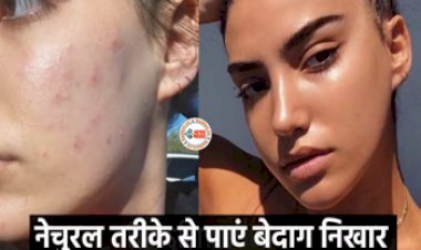 Flawless Skin: डाइट और लाइफस्टाइल में 5 आसान बदलाव करके पाएं बेदाग निखार, नेचुरल तरीके से हटेंगे स्किन के दाग-धब्बे....