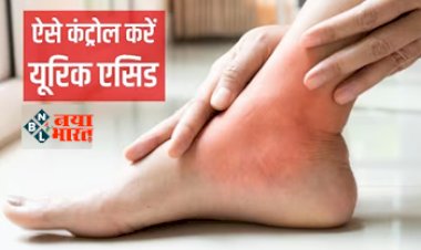 Uric Acid : यूरिक एसिड बढ़ा है तो गलती से भी न करें इन चीजों का सेवन, ल्दी कंट्रोल में आ जाएंगे यूरिक एसिड, जानें क्या हैं ये...