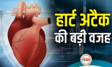 What Is Brugada Syndrome: कम उम्र में ही हार्ट अटैक आने का पता चल गया कारण, इसे ब्रुगाडा सिंड्रोम कहते हैं, जाने  क्या है ये बिमारी...