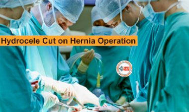 Hydrocele Cut on Hernia Operation : डॉक्टर की बड़ी लापरवाही! हर्निया के ऑपरेशन में काट दिया मरीज का प्राइवेट पार्ट, अब है फरार, ये है पूरा मामला...