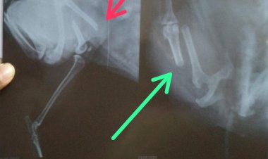 बेड से गिर कर स्वान के टूटे हुए फिमर बोन का पिन डालकर सफलता पूर्वक जोड़ा गया :डॉ देवेन्द्र यादव