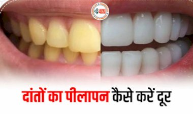 Teeth Whitening Home Remedies: दांतों में पाएं संगमरमर जैसी सफेदी, आजमाएं ये 4 आसान से उपाय...