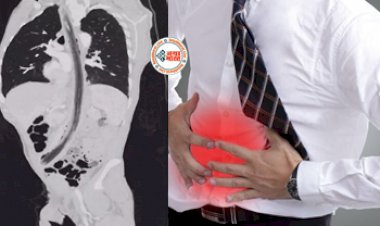 Person Swallowed the Rod : अचानक पेट में हुई दर्द तो अस्पताल पहुंचा शख्स, लेकिन जैसे ही डॉक्टर ने कराया एक्स-रे, दिखा कुछ ऐसा...