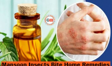 Mansoon Insects Bite Home Remedies : मानसून में बढ़ जाता है कीड़ों का खतरा! जानिए इनके काटने और उपचार के लिए घरेलू उपाय...