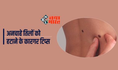 Mole home remedies : अनचाहे तिलों से है परेशान! तो अपनाएं ये घरेलु तरीका, सारे तिल हो जाएंगे साफ, देखिये आसान तरीका...
