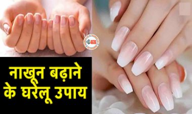 Nail Groth Tips : पाना चाहते है लम्बे और चमकदार नाख़ून! तो आजमाएं ये घरेलू उपाय...