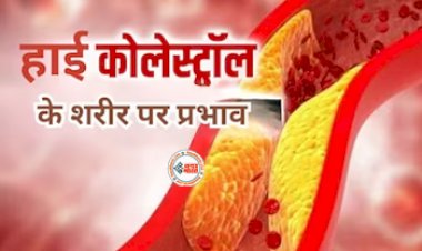 High Cholesterol Symptoms : हाई कोलेस्ट्रॉल शारीर के लिए है बेहद घातक! अगर आपको दिख रहे है ये लक्षण,  तो न करें देर, ऐसे करें बचाव...