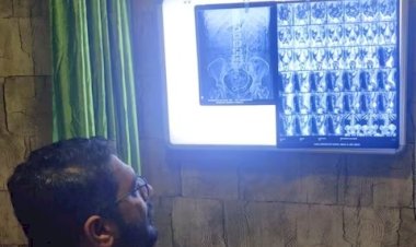 OMG : छत्तीसगढ़ में मिली तीन किडनियों वाली महिला, पूरी दुनिया में ऐसे केवल 100 लोग....