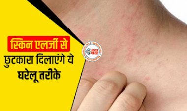 Beauty Tips: त्वचा पर होने वाले रैशेज और खुजली से छुटकारा दिलाएंगी ये घरेलू तरीके, जल्द मिलेगा छुटकारा...