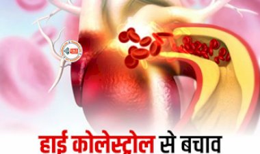 How To Reduce Cholesterol : हाई Cholesterol से पाना चाहते है छुटकारा! तो इन चीजों को बना ले डाइट का हिस्सा, जल्द ही मिलेगा आराम...