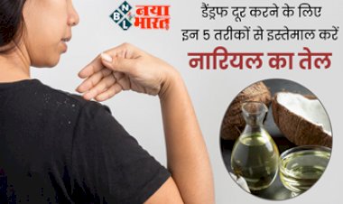 Dandruff Remedies : डैंड्रफ दूर करने के लिए इन तरीकों से इस्तेमाल करे नारियल का तेल, रूसी हो जाएगी कोसो दूर...