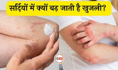 Winter Itch: सर्दियों में ड्राई स्किन पर होती खुजली से हैं परेशान? ये आसान उपाय दिलाएंगे आराम...