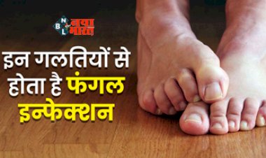 Fungal Infection in Nails : इन गलतियों के कारण होता है फंगल इन्फेक्शन, जाने इससे बचाव के लिए घरेलू उपचार...