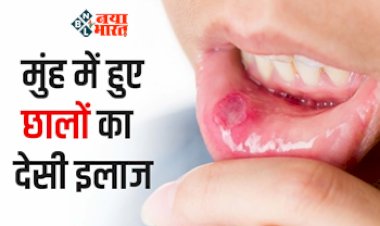 Honey Benefits as Powerfood: बार-बार मुंह में छाले और गले में खिचखिच से है परेशान! तो आज ही इस पावर फूड से करें इलाज, कई औषधीय गुणों से भरपूर...