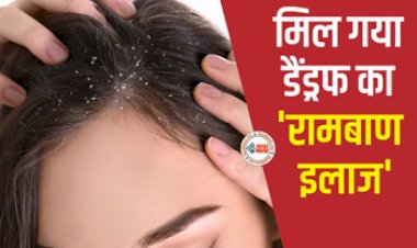 Dandruff Hair Fall : मिल गया डैंड्रफ का रामबाण ईलाज, अपनाएँ ये घरेलू उपचार, जाने इस्तेमाल करने का तरीका...