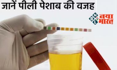 Yellow Urine Reason: सुबह पीला पेशाब आना है इस अंग की गड़बड़ी का संकेत! कारण जान रहें सतर्क...