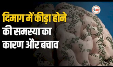 Ways to Avoid Brain Worms : दिमाग में कीड़े पड़ने के ये है लक्षण, हो जाएं सतर्क नहीं तो खोखली हो जाएगी खोपड़ी, जाने इससे बचाव के उपाय...